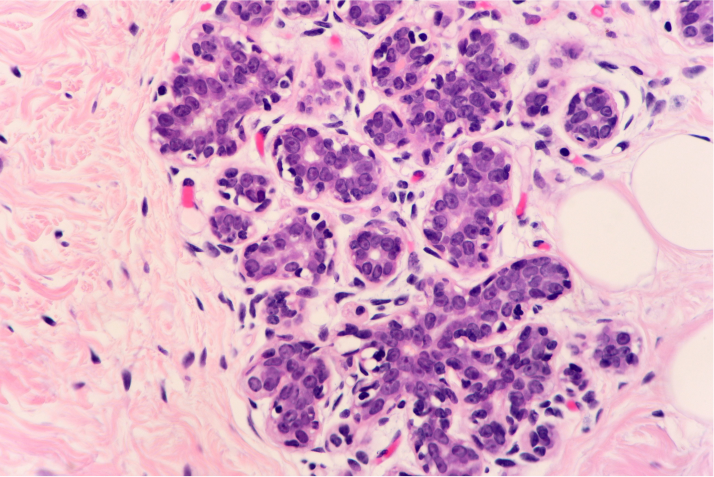RTU 1 Decoding Cancer@2x